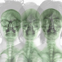 0 supergrass rock vinyl lp xray